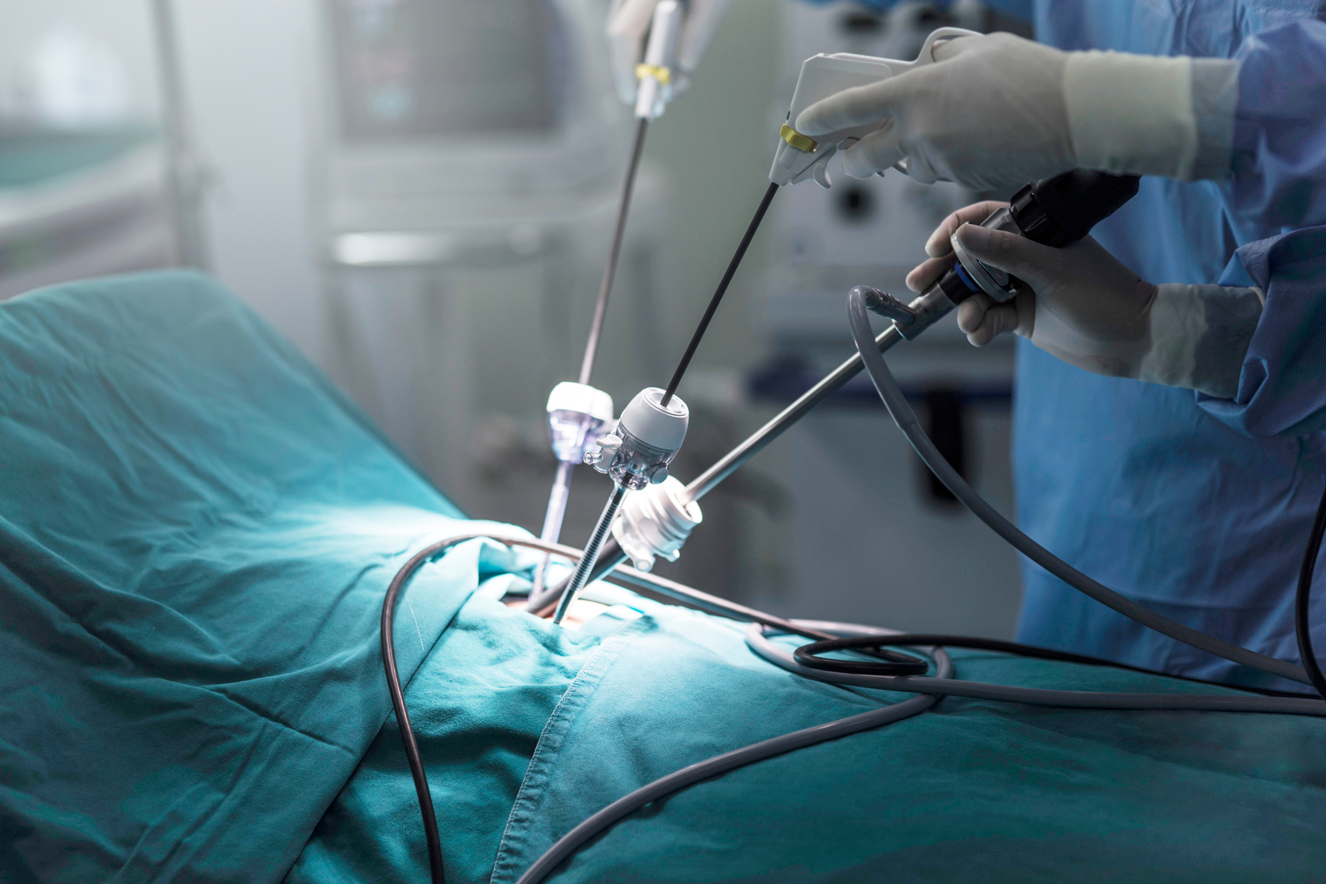 Frequently Asked Questions on Operative Technique of Laparoscopic